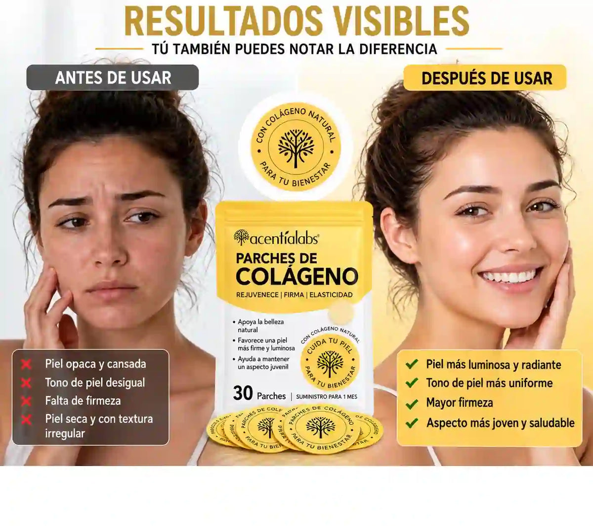 COLLAGEN PATCHES